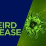 Weird disease: दुनिया की सबसे अजीब बीमारियां, जिससे लड़ना है मुमकिन ही नहीं!